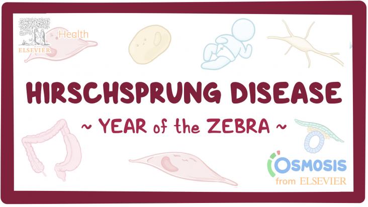 Hirschsprung Disease