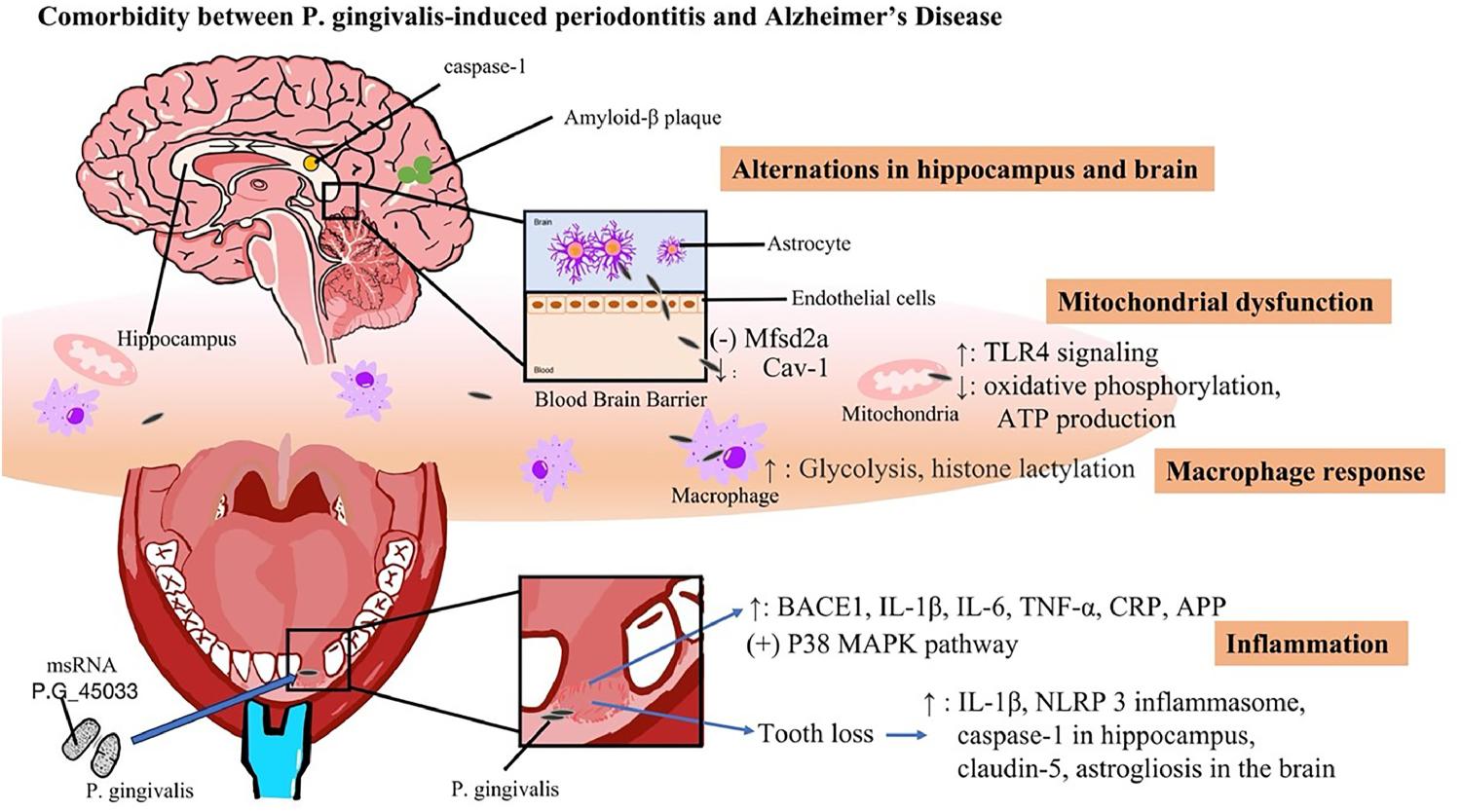 Fig. 5. Mechanisms of comorbidity between P. gingivalis-induced periodontitis and AD.