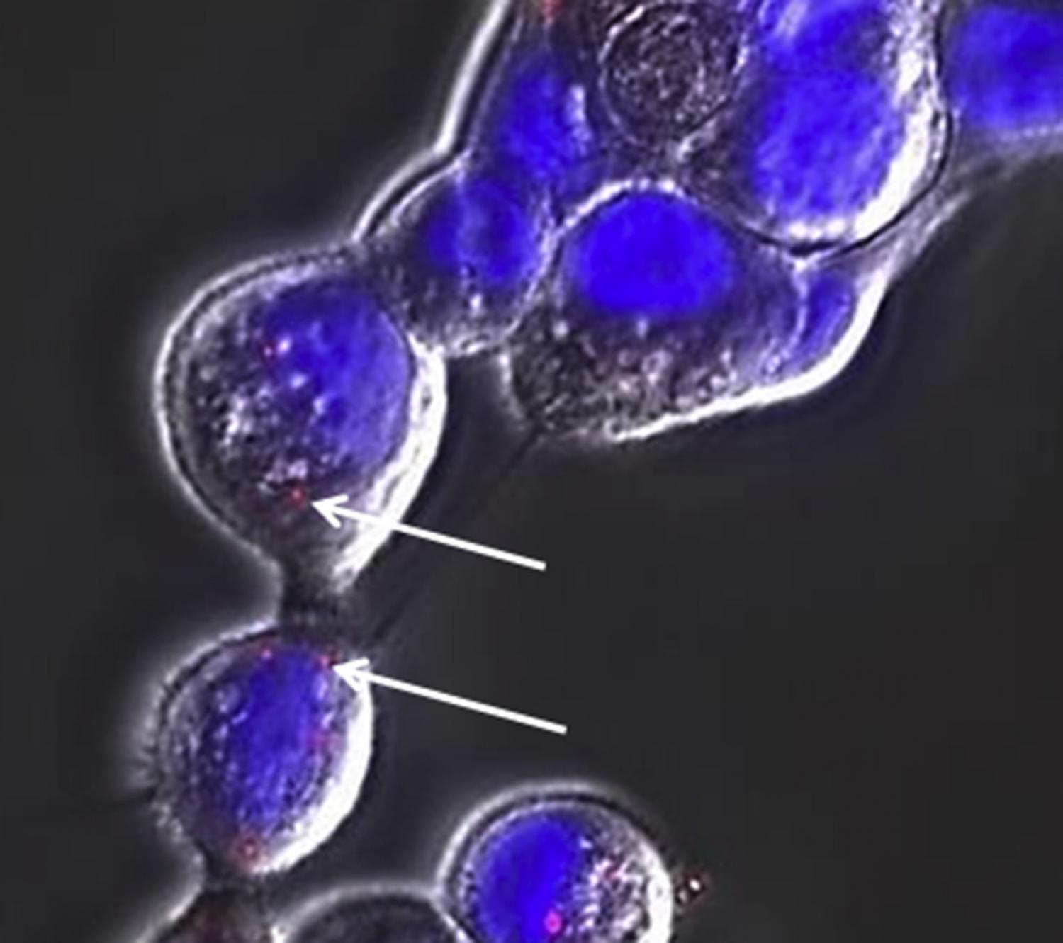 Human keratinocytes, which have taken up red fluorescent polystyrene particles