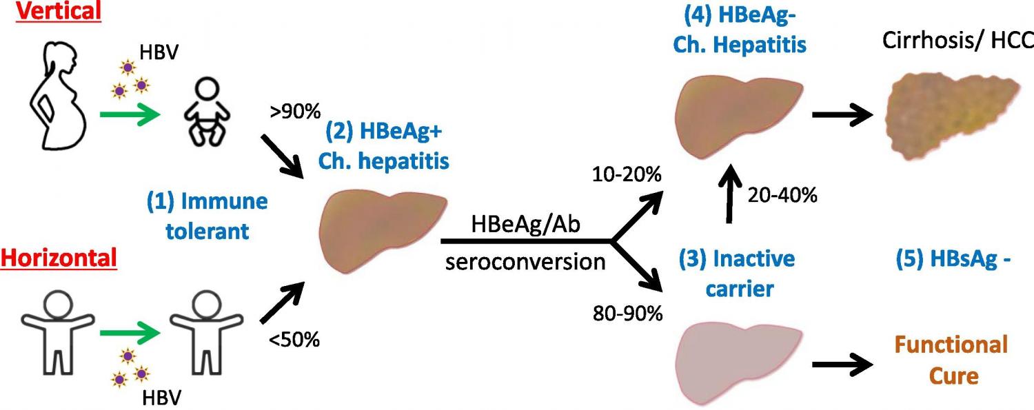 Natural history of chronic HBV infections.