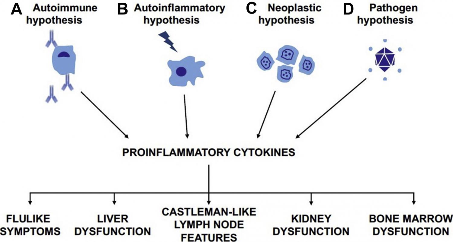 Hypothesized etiologic drivers of iMCD. The CD research community, led by the CDCN, recently proposed 4 candidate etiologic drivers of iMCD pathogenesis: iMCD may be due to (A) self-reactive antibodies, (B) germline mutations in genes regulating inflammation, (C) acquired oncogenic mutations, o