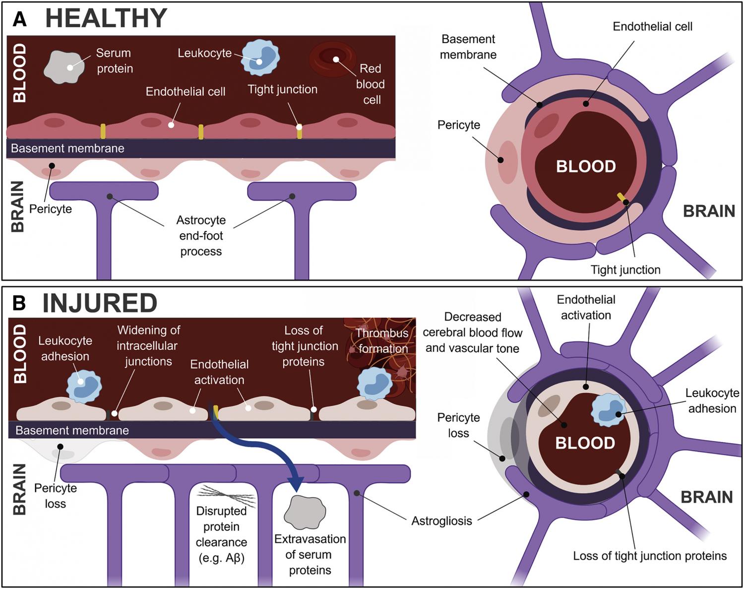 Healthy and Injured Neurovascular Unit