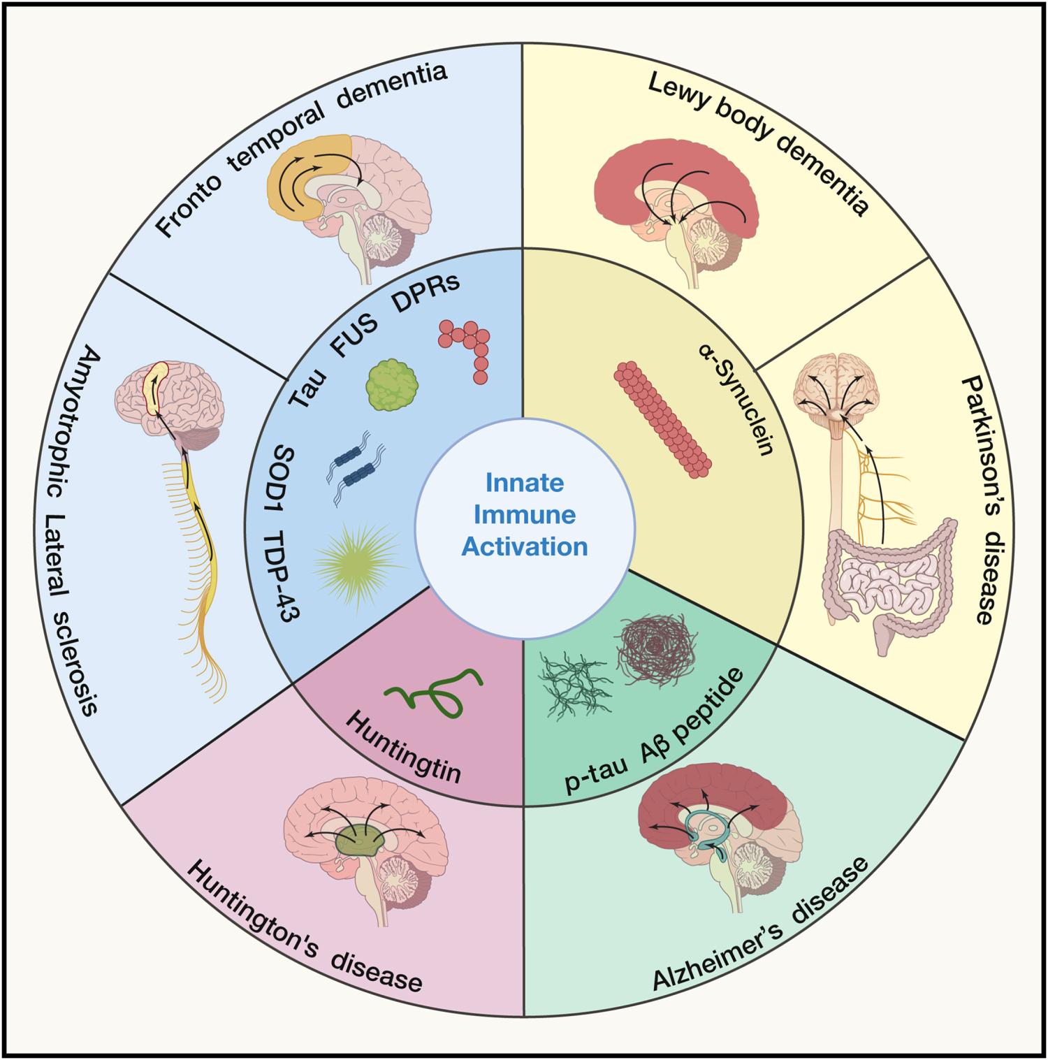 Figure 1. Immune activation and neuropathological hallmarks in common NDDs