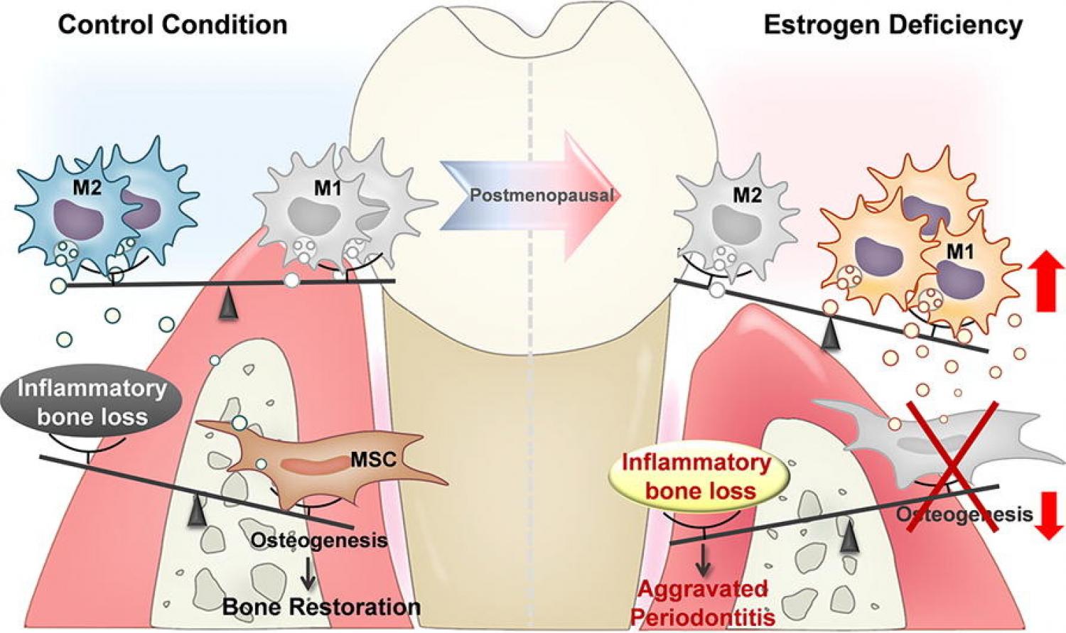 Graphical abstract from Small RNA cargo armed extracellular vesicles alleviate periodontitis in OVX mice via M2 macrophage polarization Graphical abstract showing the effect of estrogen-deficiency on a tooth