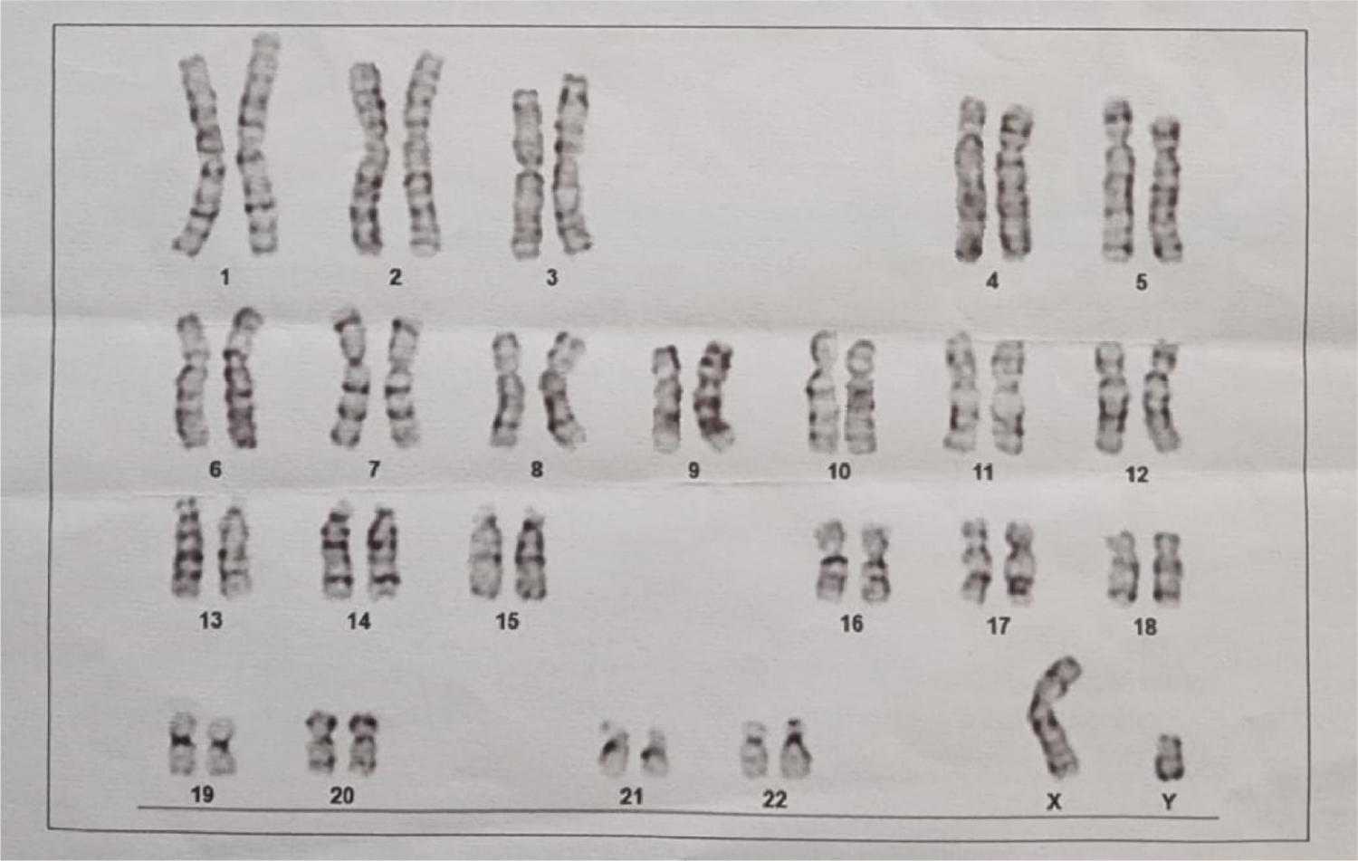 Chromosomal examination revealed a 46XY karyotype pattern. Chromosomal examination revealed a 46XY karyotype pattern.