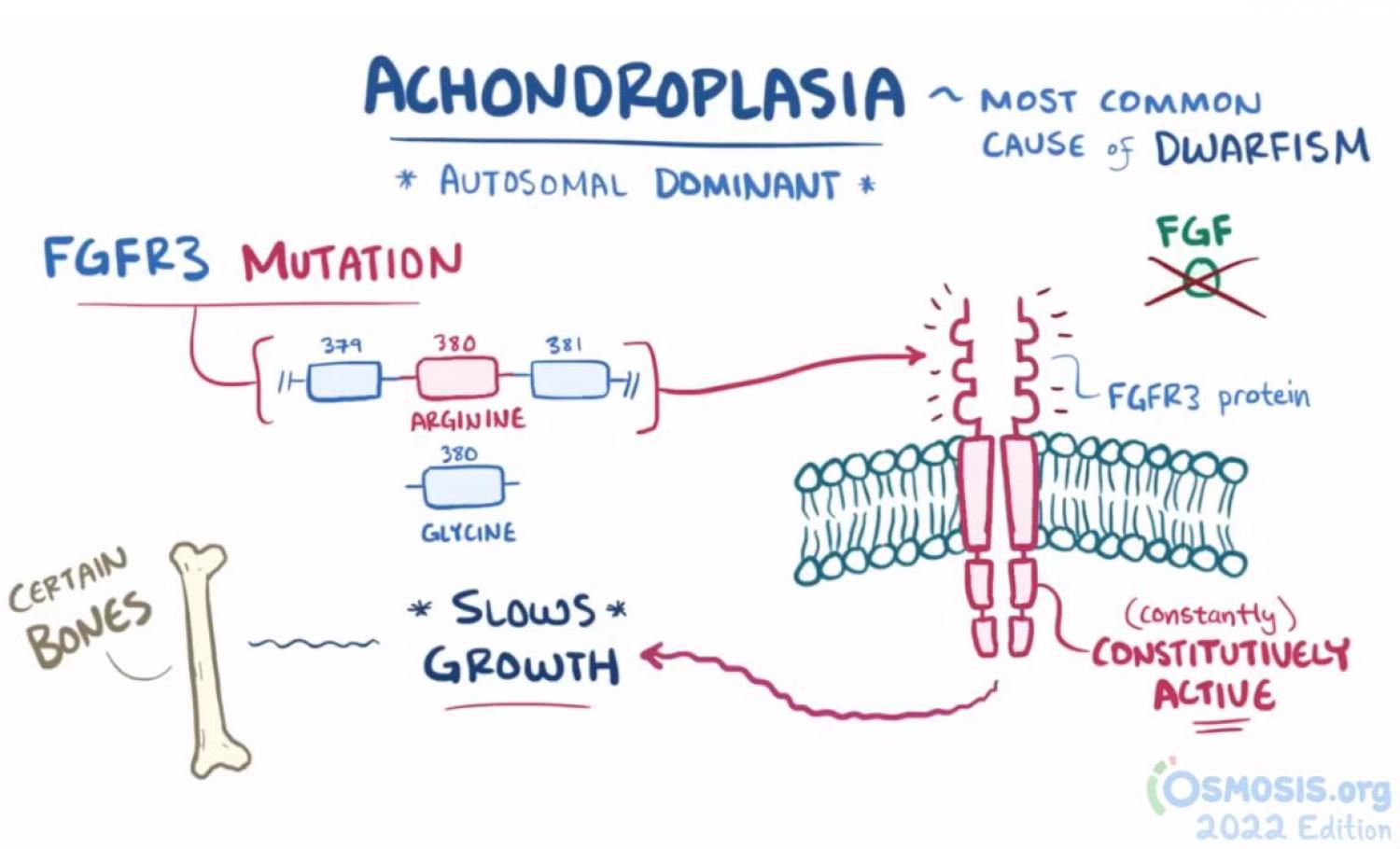 Achondroplasia Screenshot of Educational Video