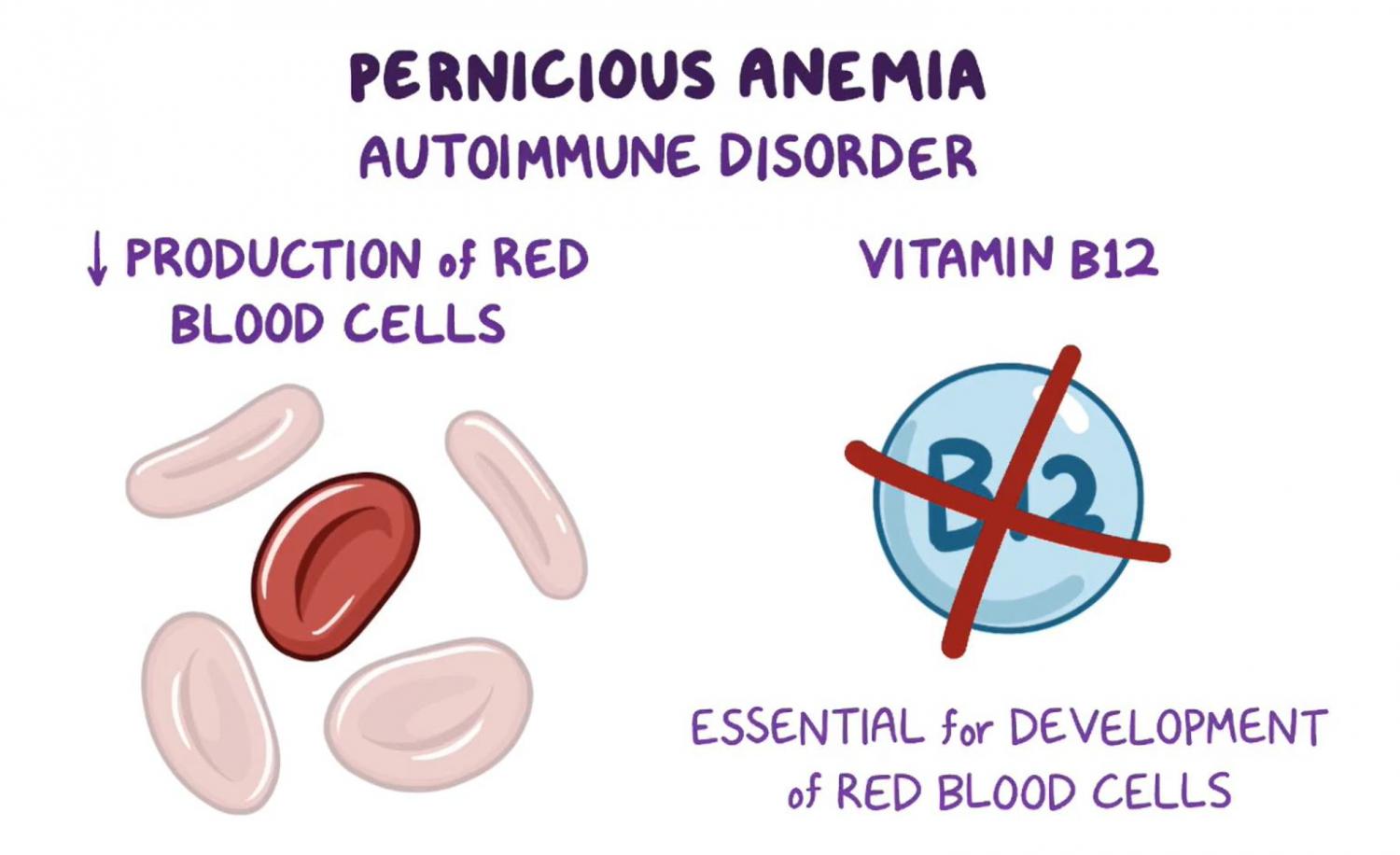Pernicious Anemia